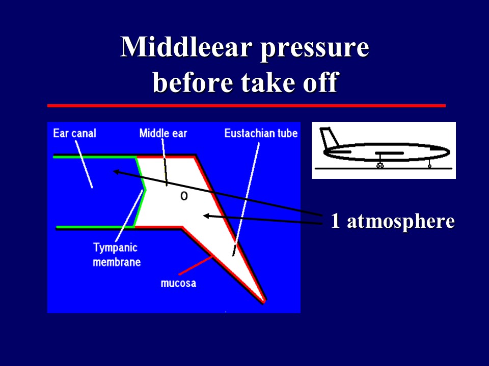 Middleear pressure before take off