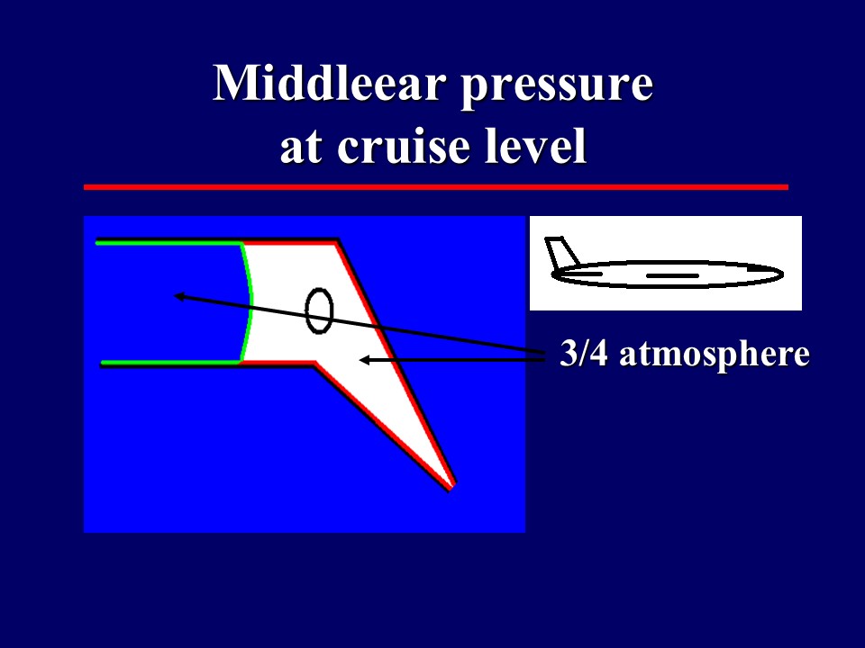 Middleear pressure at cruise level