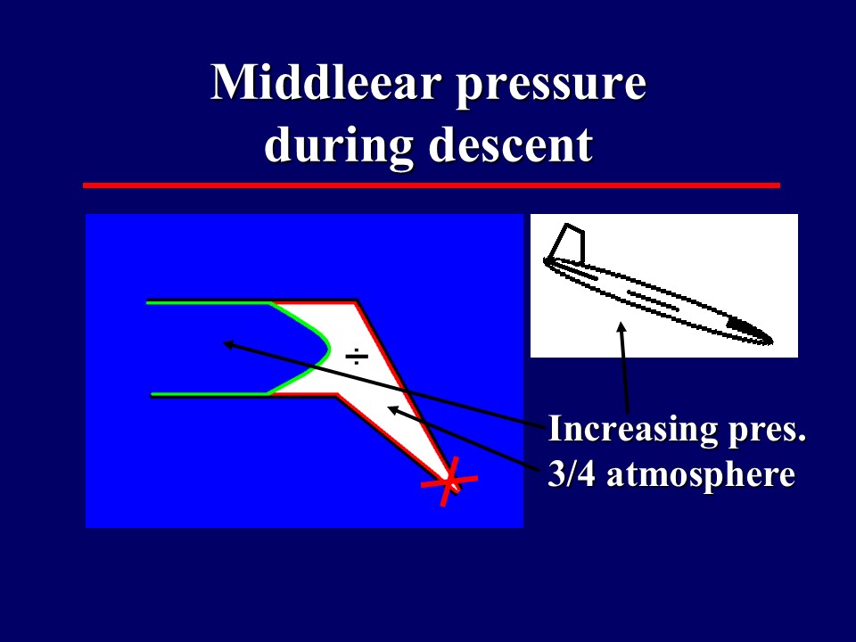 Middleear pressure during descent