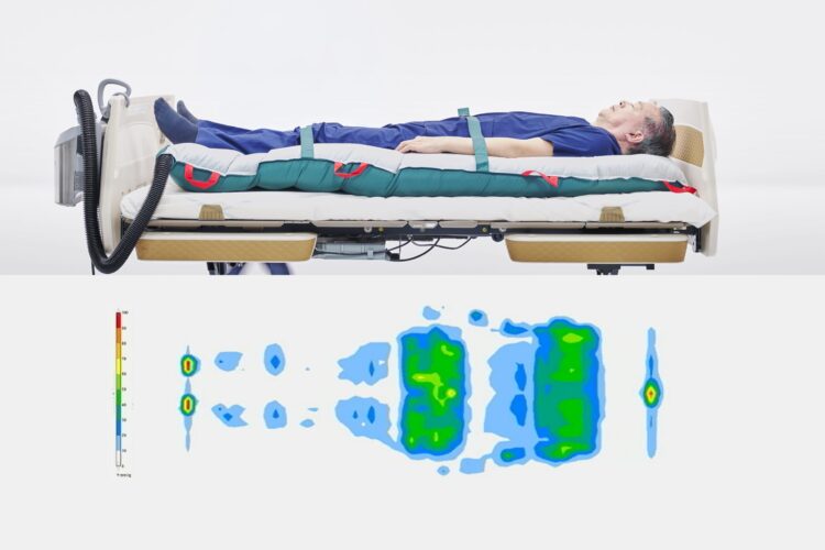 ICUの定期的な除圧を少人数で標準化したホバーマットの導入事例