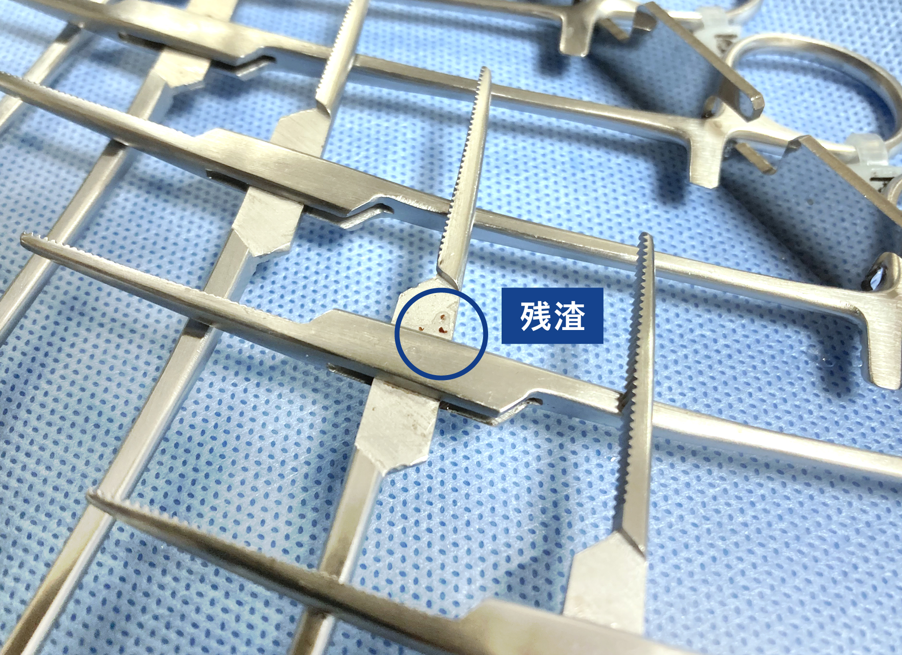 残渣